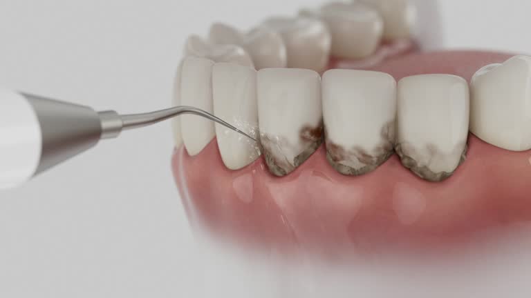 Trusted Dental Implants service in Tontitown, AR - Dentist Open Now